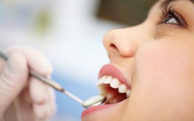 What You Need To Know About Cosmetic Dentistry in Tuscaloosa